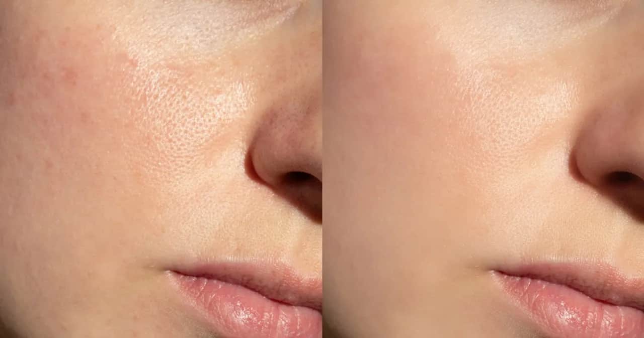 Aplikacja kremu BB: Sekret nieskazitelnej cery bez efektu maski