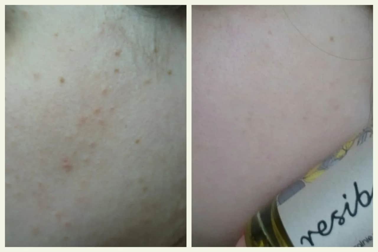 Resibo Kontrola Sebum: Czy to serum rozwiąże Twoje problemy z cerą?